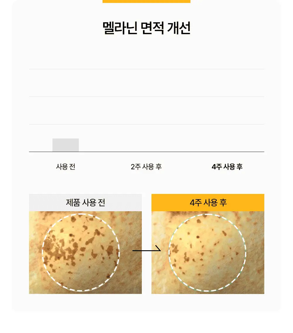 [기미/잡티/미백] 원진이펙트 멜라리스 크림 80g 상세페이지 16